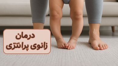 درمان زانوی پرانتزی