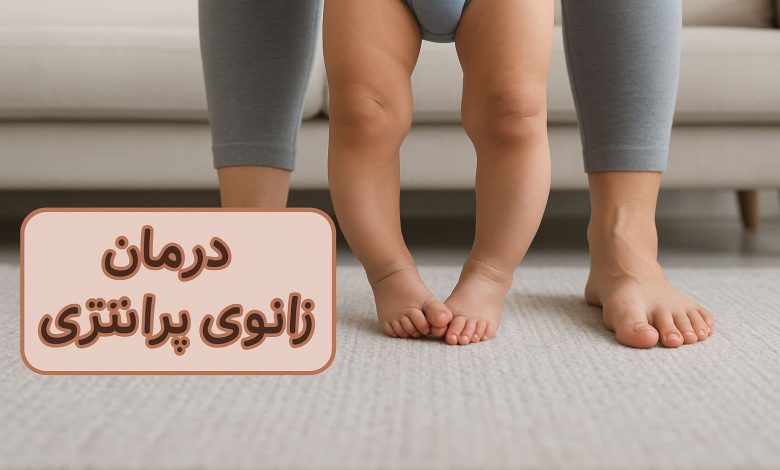 درمان زانوی پرانتزی