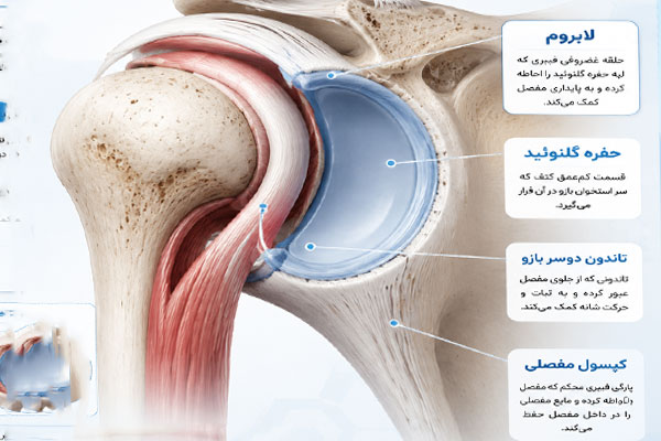 699 پارگی اسلب شانه