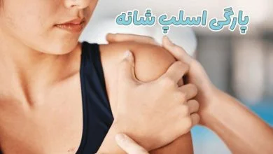 پارگی اسلپ شانه