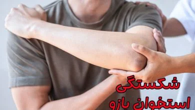 شکستگی سر استخوان بازو