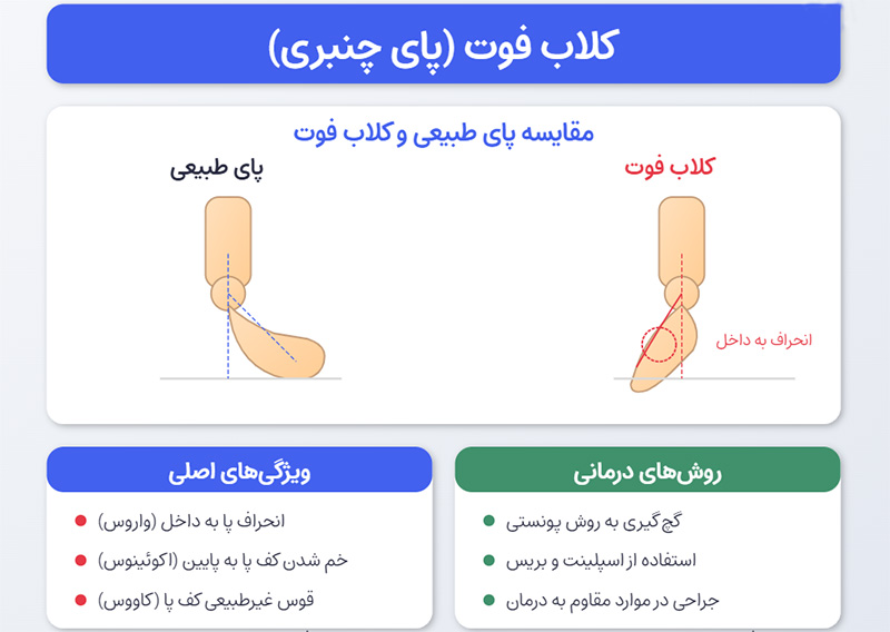 کلاب فوت