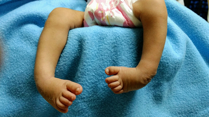 کلاب فوت