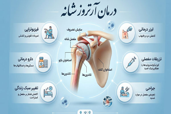 6589 درمان آرتروز شانه