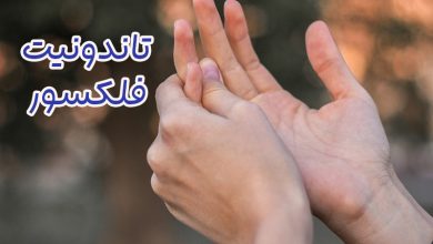تاندونیت فلکسور