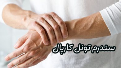 سندرم تونل کارپال