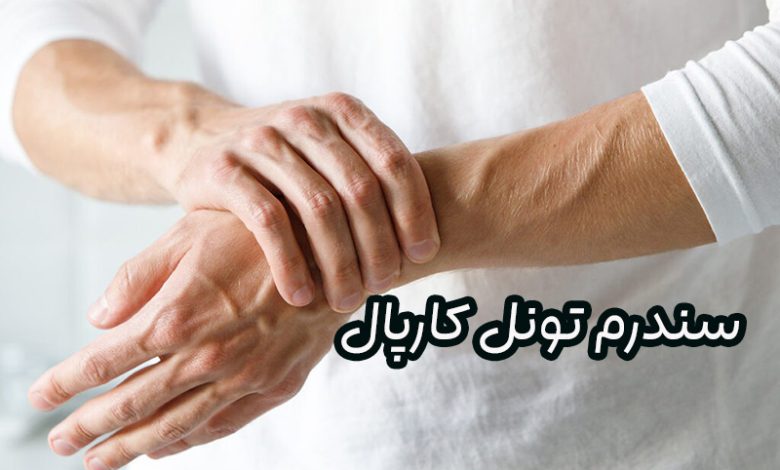سندرم تونل کارپال