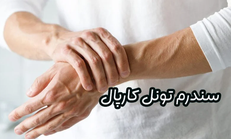 سندرم تونل کارپال