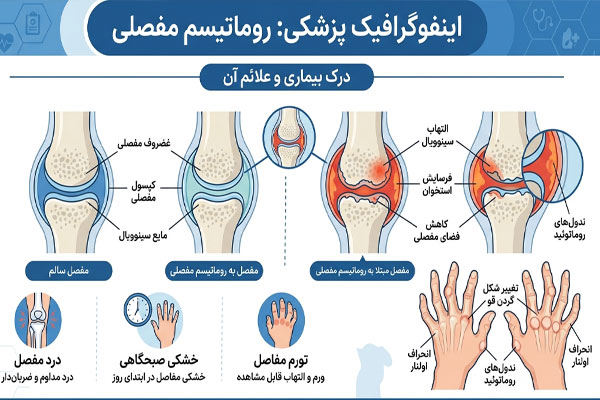ر. آرتریت روماتوئید