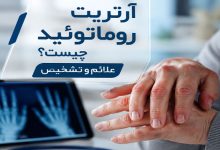 آرتریت روماتوئید