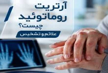 آرتریت روماتوئید