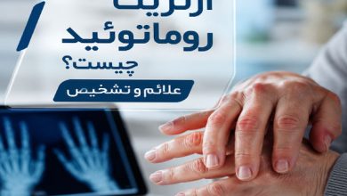 آرتریت روماتوئید