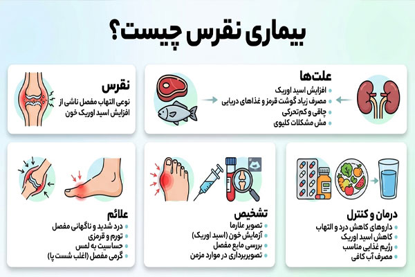 بیماری نقرس