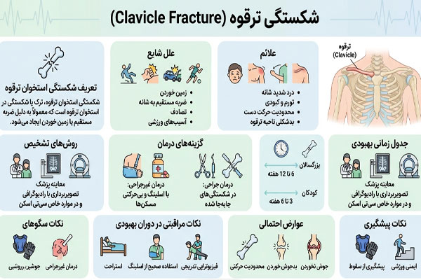 شکستگی ترقوه