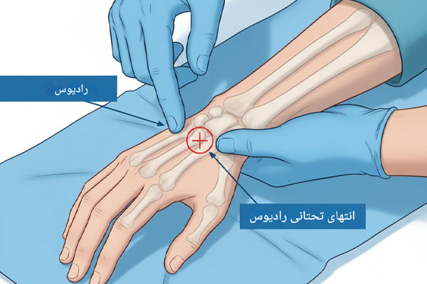  لمس استخوان های رادیوس