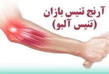 تنیس آلبو