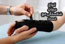 شکستگی مچ دست