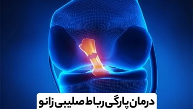 هزینه عمل رباط صلیبی زانو