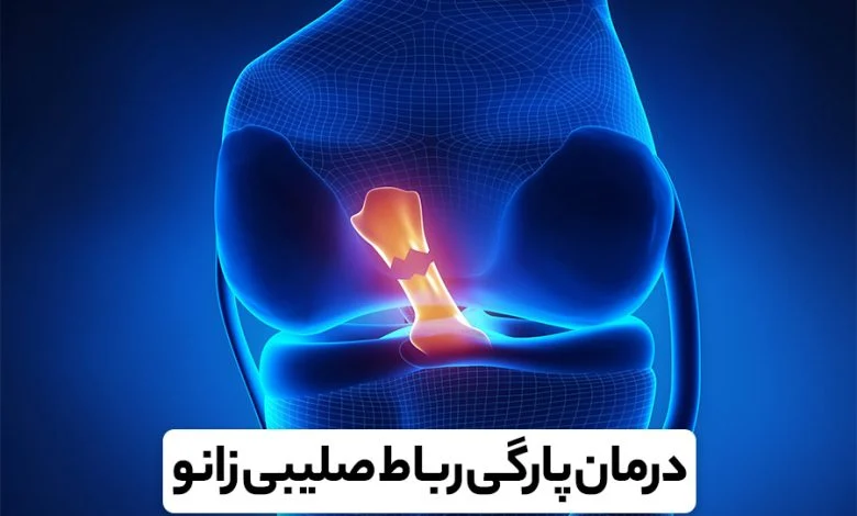 هزینه عمل رباط صلیبی زانو