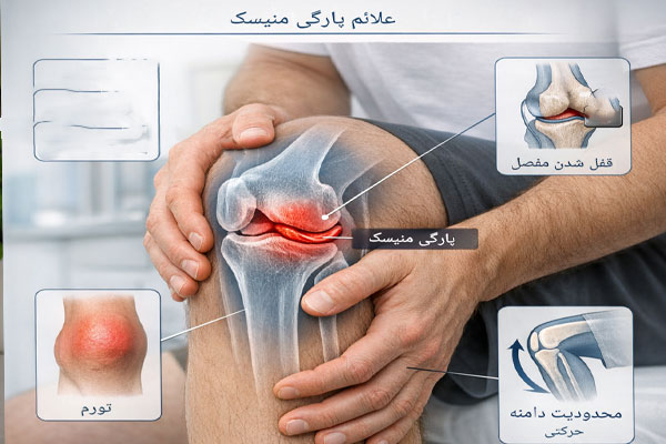 صدای تق تق زانو