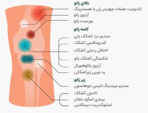 انواع زانو درد