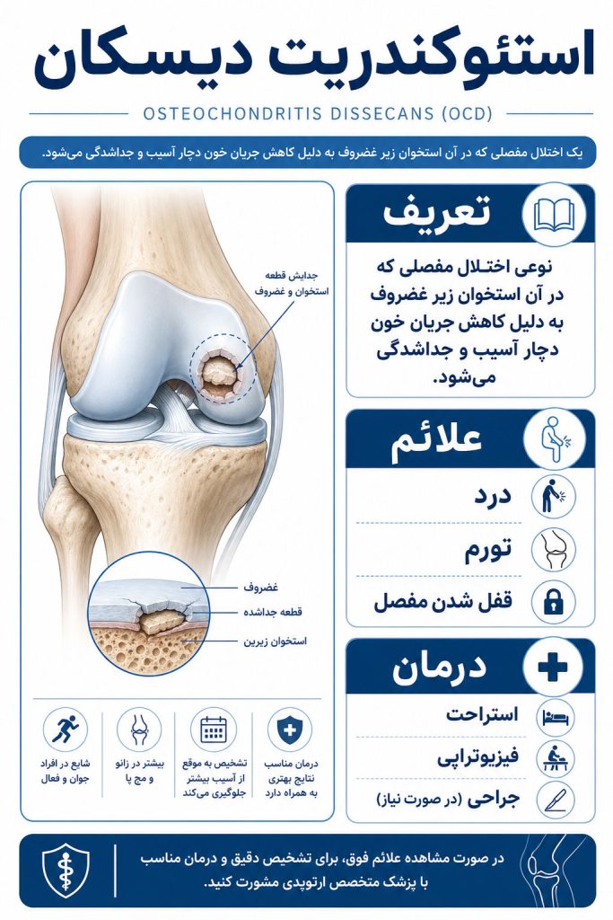 بیماری استئوکندریت دیسکان