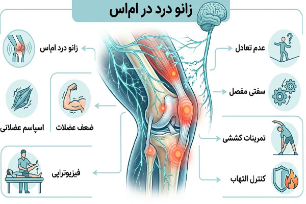 6588 زانو درد ام اس