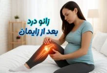 زانو درد بعد از زایمان