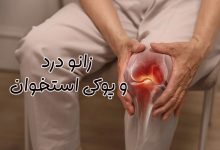 زانو درد ناشی از پوکی استخوان