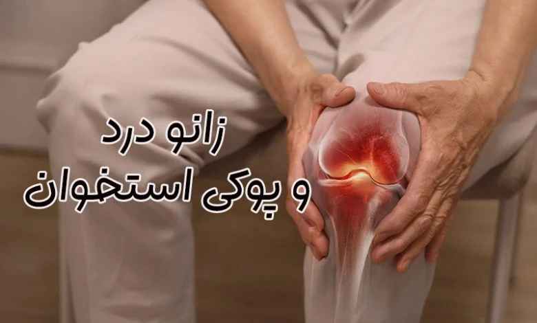 زانو درد ناشی از پوکی استخوان