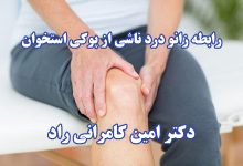 زانو درد ناشی از پوکی استخوان