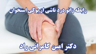 زانو درد ناشی از پوکی استخوان