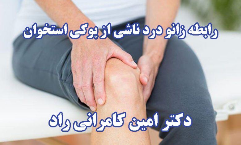 زانو درد ناشی از پوکی استخوان