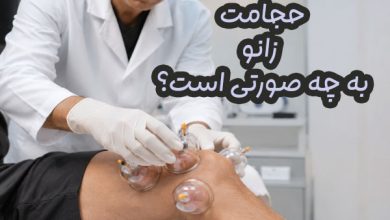 حجامت زانو
