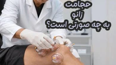 حجامت زانو
