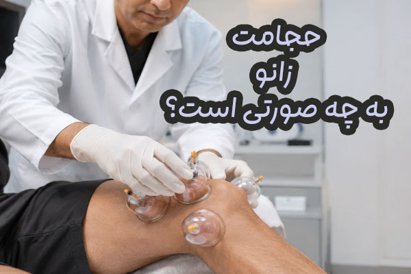 حجامت زانو