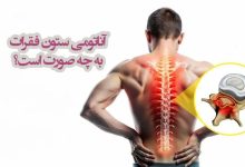 آناتومی ستون فقرات
