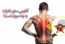 آناتومی ستون فقرات