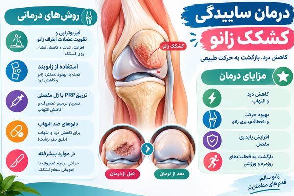 درمان ساییدگی کشکک زانو