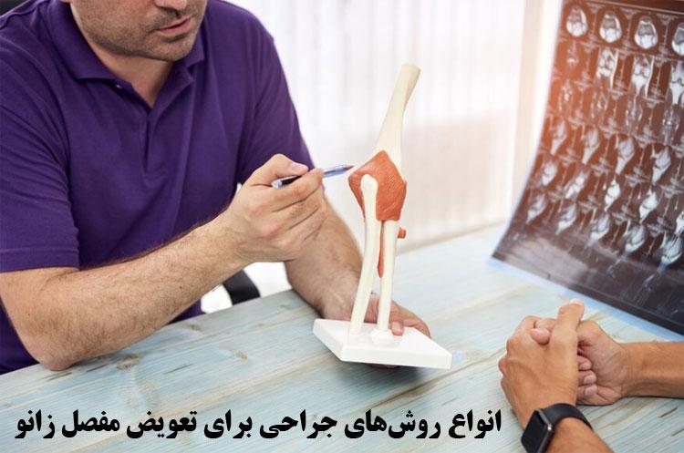 انواع-روش‌های-جراحی-برای-تعویض-مفصل-زانو