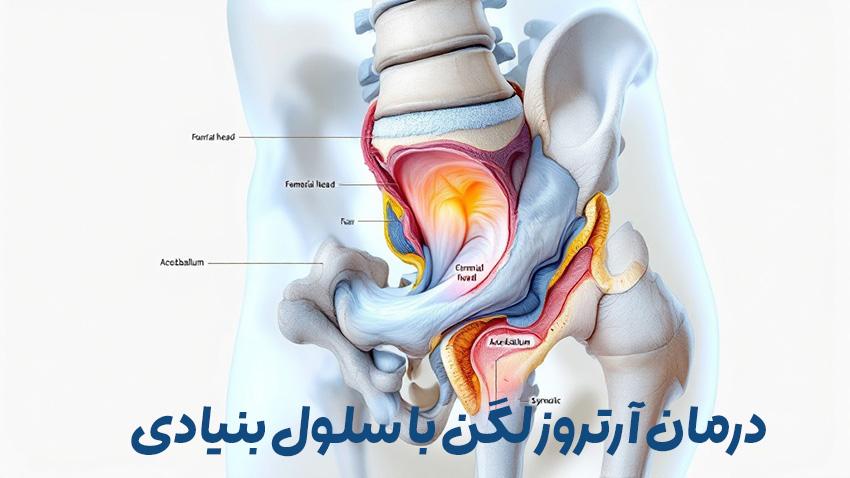 سلول بنیادی لگن