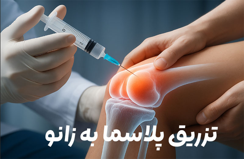 تزریق پلاسما به زانو