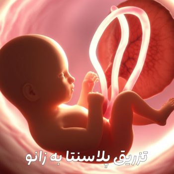 تزریق-پلاسنتا-به-زانو
