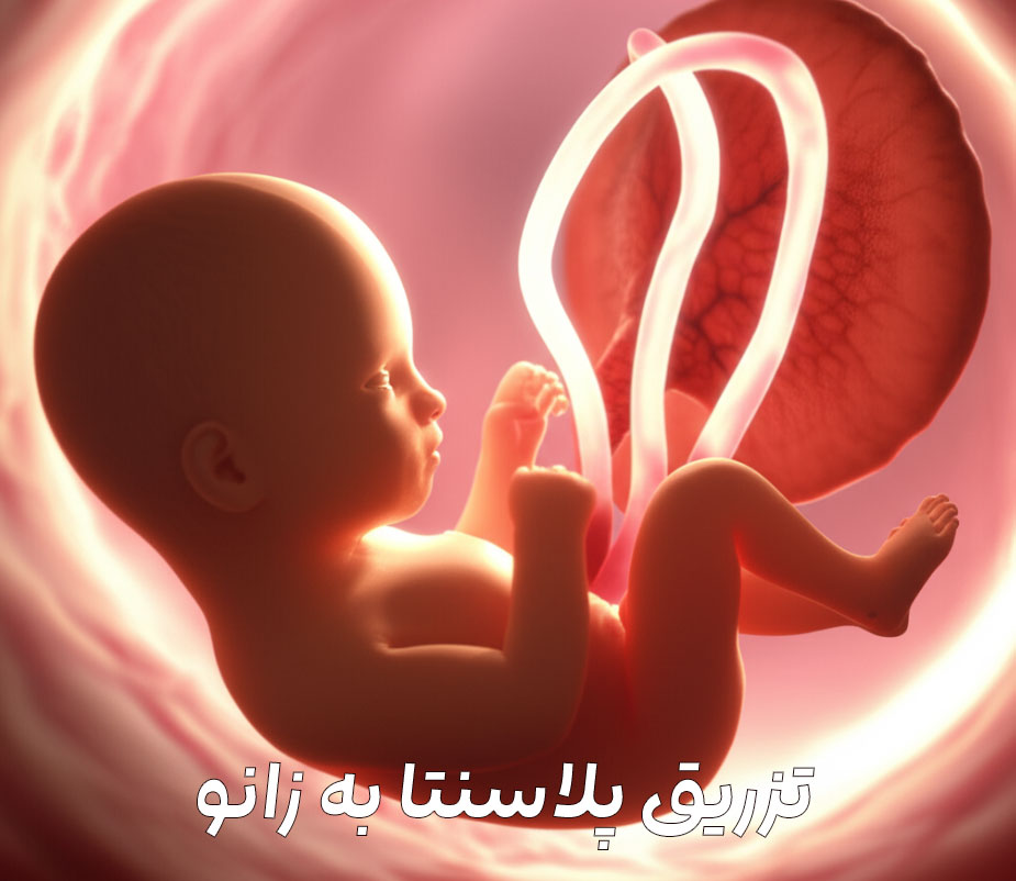 درمان آرتروز زانو با تزریق پلاسنتا بدون جراحی،عصاره جفت جنین
