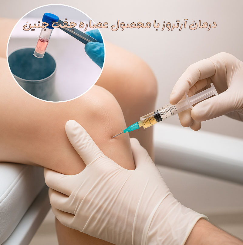 اثربخشی و درمان آرتروز با محصول عصاره جفت جنین