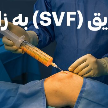تزریق-SVF-به-زانو