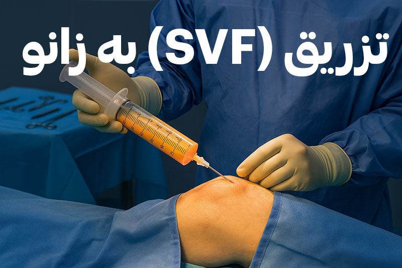 تزریق Svf چربی به زانو
